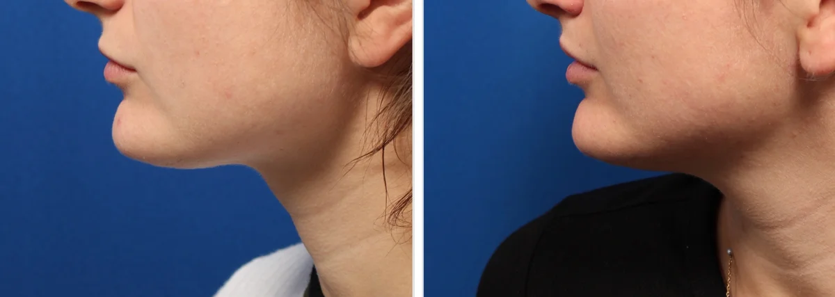 DA34B565-63D3-47AB-9CFC-8BF89682BC03