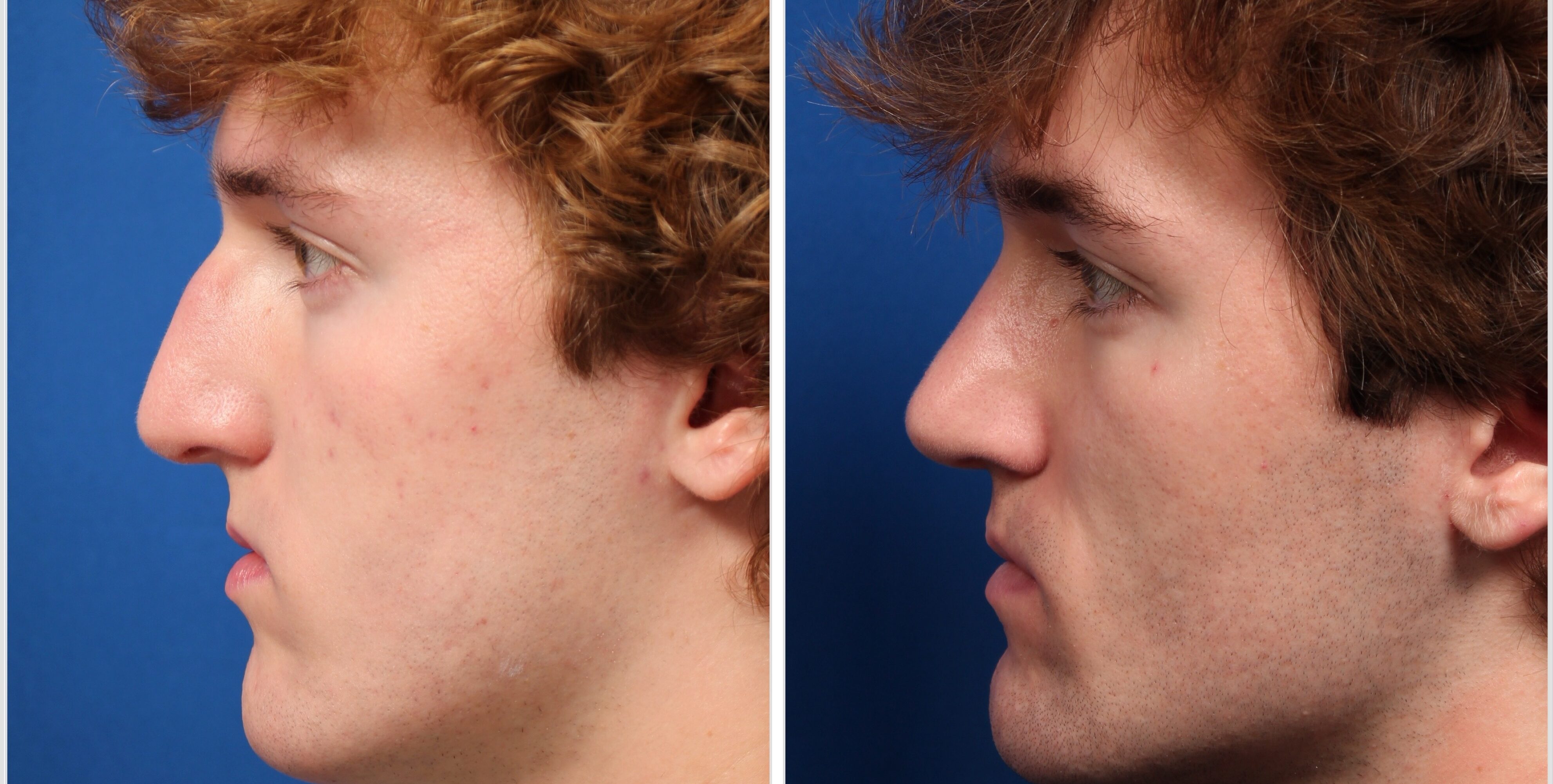 E1CC37CA-5376-4DEA-A20D-9C2FFD65E04F