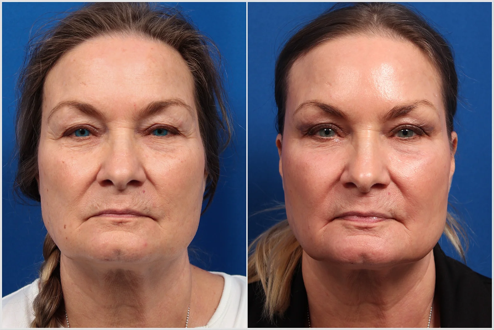 E7215E77-8640-4679-BF53-49525456BB2C