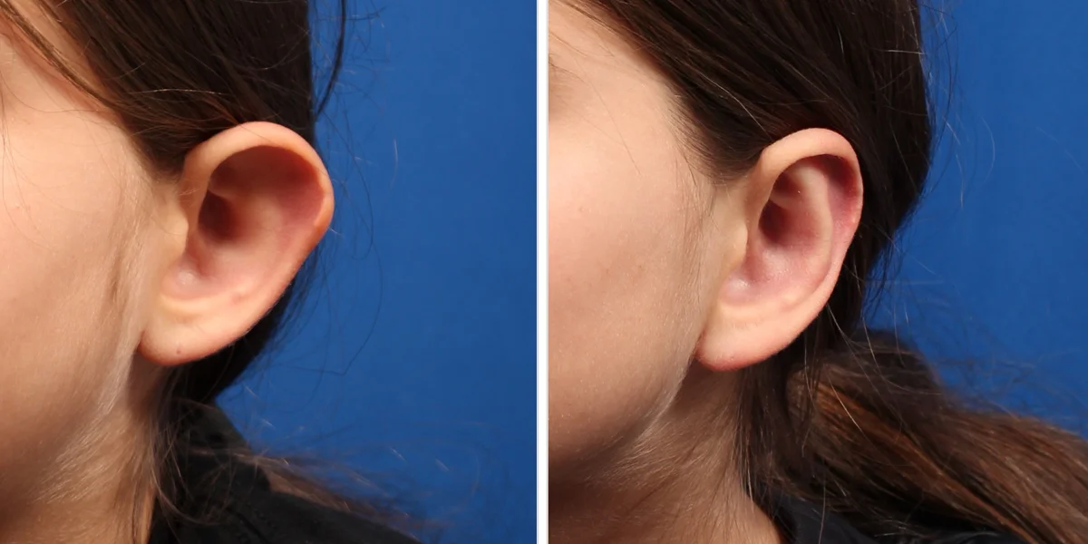 F0EEECFF-D5F2-4EF8-9E67-AE9E525A1293