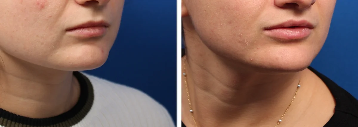 F5ED06D7-F58E-4392-A213-2DC2E9E5FF5D