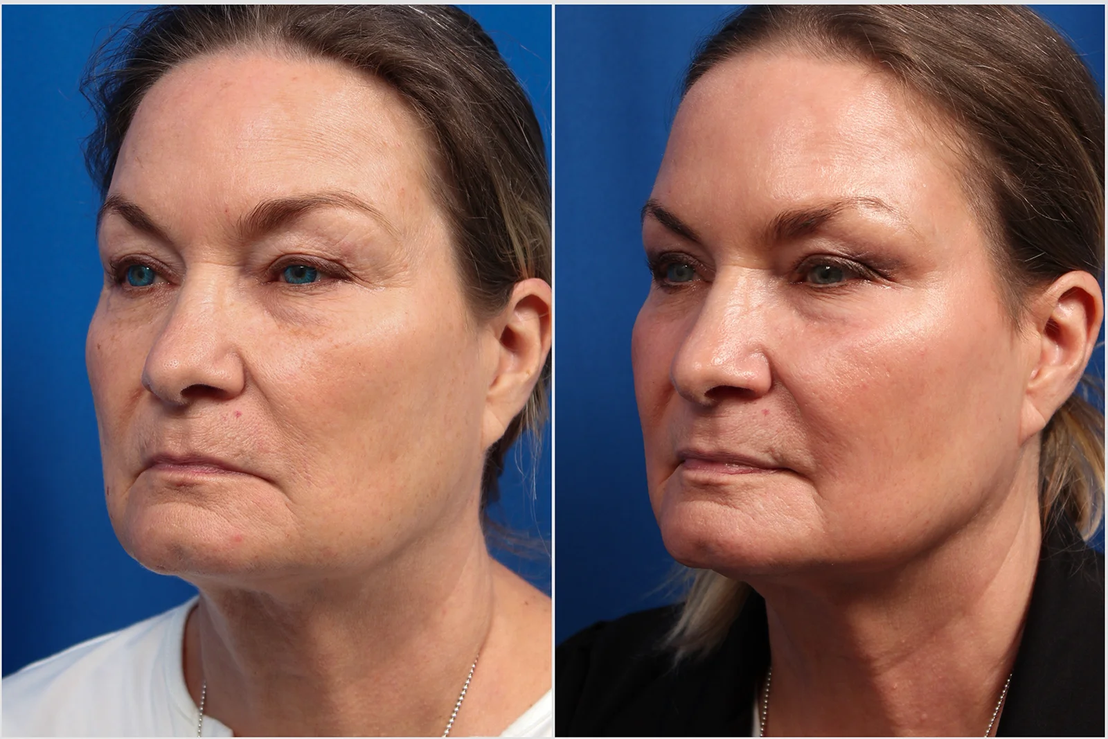 FDC063FE-57DD-4325-BCBA-E20FEC8129D2